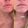 مکمل تقویت پوست اسکین تامین _ Skin Tamin