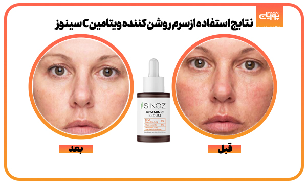 سرم روشن کننده ویتامین C سینوز