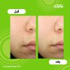 محلول ضد جوش تی تری دکتر جارت
