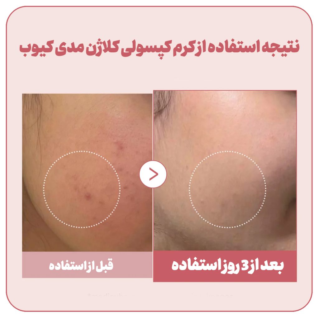 کرم کپسولی کلاژن و PDRN مدی کیوب
